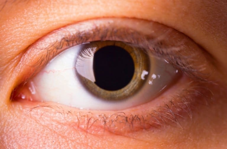 A close up of a person's eye undergoing drug detox at an outpatient program.
